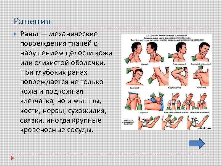 Ранения Раны — механические повреждения тканей с нарушением целости кожи или слизистой оболочки. При