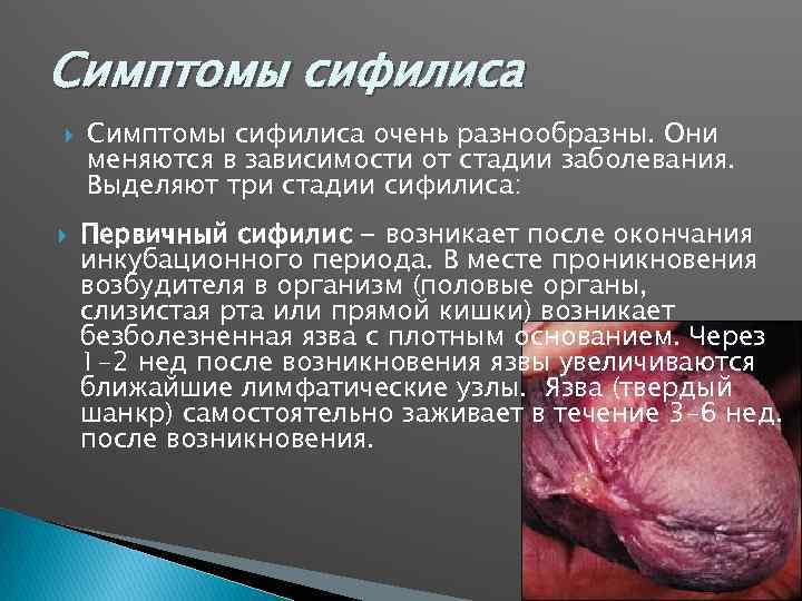 Симптомы сифилиса очень разнообразны. Они меняются в зависимости от стадии заболевания. Выделяют три стадии