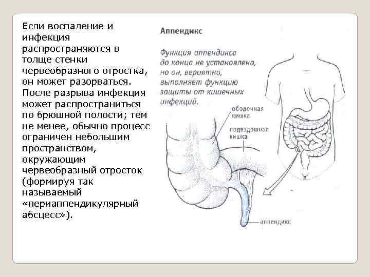 Если воспаление и инфекция распространяются в толще стенки червеобразного отростка, он может разорваться. После