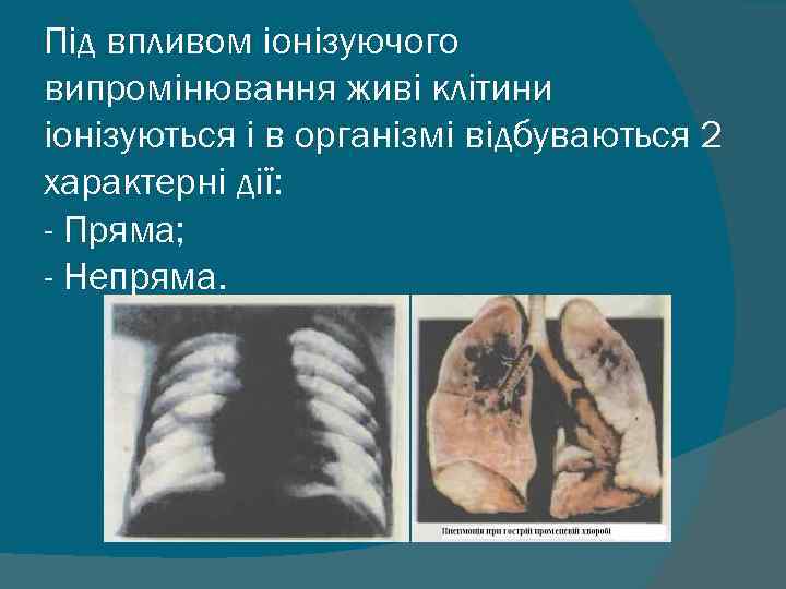 Під впливом іонізуючого випромінювання живі клітини іонізуються і в організмі відбуваються 2 характерні дії: