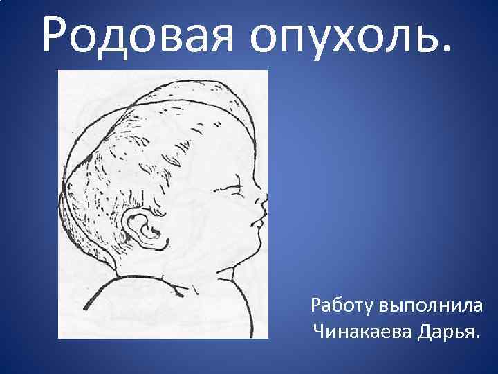 Картинки родовая опухоль