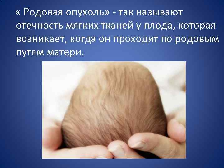  « Родовая опухоль» - так называют отечность мягких тканей у плода, которая возникает,