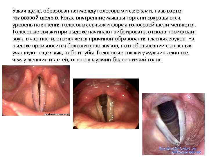 Узкая щель, образованная между голосовыми связками, называется голосовой щелью. Когда внутренние мышцы гортани сокращаются,