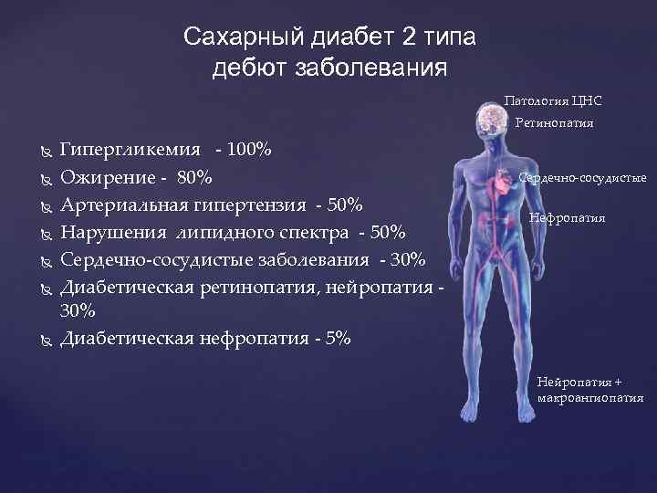 Заболевание 30. Сахарный диабет 2 типа. Дебют сахарного диабета 2 типа. Дебют сахарного диабета 1 типа. Сахарный диабет 2 типа внутренние болезни.