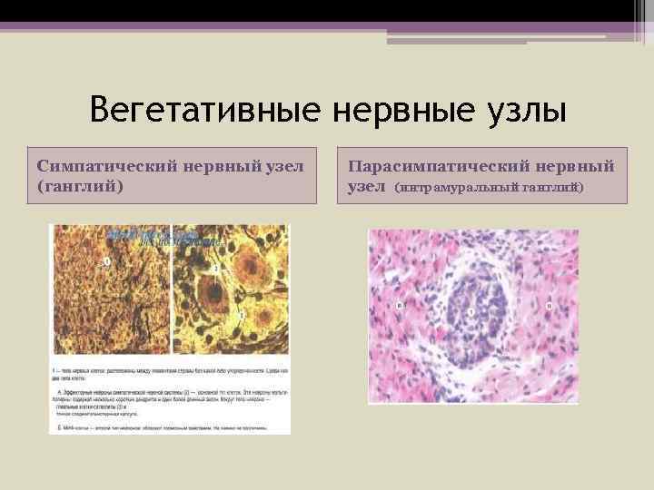 Вегетативные нервные узлы Симпатический нервный узел (ганглий) Парасимпатический нервный узел (интрамуральный ганглий) 