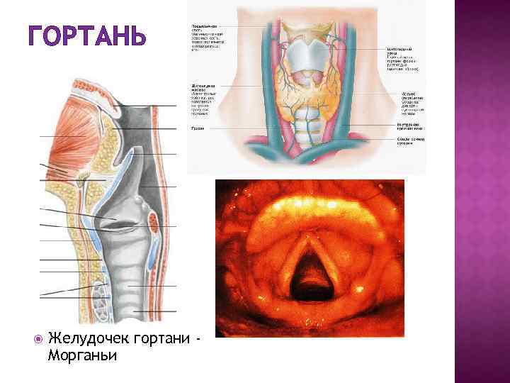 ГОРТАНЬ Желудочек гортани Морганьи 