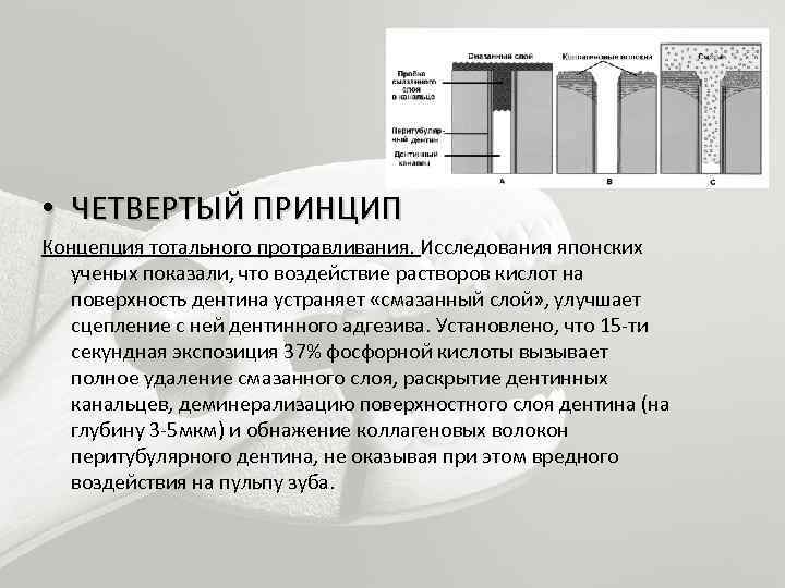 Протокол адгезивной фиксации керамических реставраций презентация