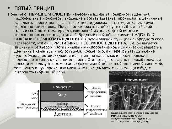 Адгезивные системы в стоматологии презентация