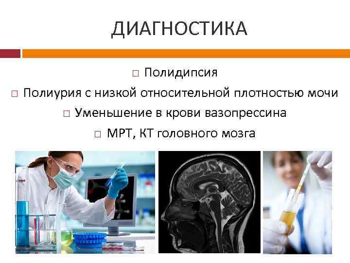 ДИАГНОСТИКА Полидипсия Полиурия с низкой относительной плотностью мочи Уменьшение в крови вазопрессина МРТ, КТ