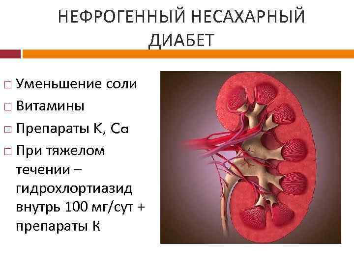 НЕФРОГЕННЫЙ НЕСАХАРНЫЙ ДИАБЕТ Уменьшение соли Витамины Препараты K, Ca При тяжелом течении – гидрохлортиазид