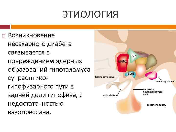 ЭТИОЛОГИЯ Возникновение несахарного диабета связывается с повреждением ядерных образований гипоталамуса супраоптикогипофизарного пути в задней