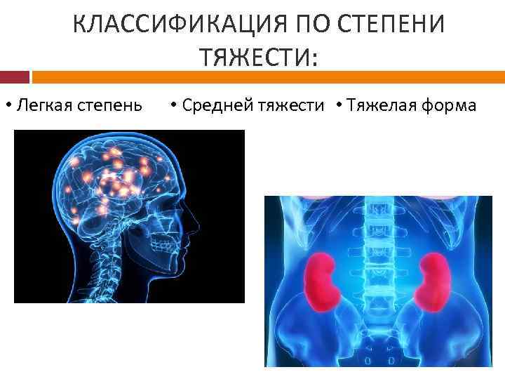 КЛАССИФИКАЦИЯ ПО СТЕПЕНИ ТЯЖЕСТИ: • Легкая степень • Средней тяжести • Тяжелая форма 