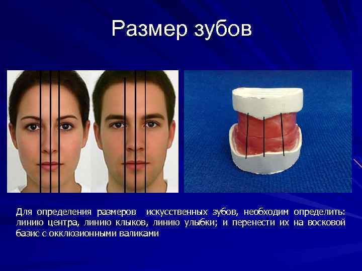 Размер зубов Для определения размеров искусственных зубов, необходим определить: линию центра, линию клыков, линию