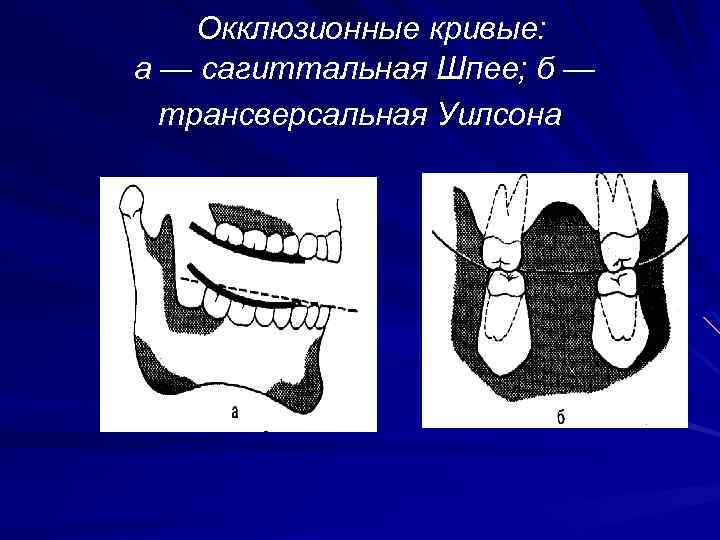 Окклюзионные кривые: а — сагиттальная Шпее; б — трансверсальная Уилсона 