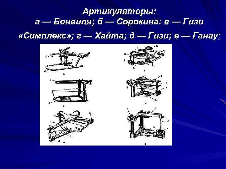 Артикуляторы: а — Бонвиля; б — Сорокина: в — Гизи «Симплекс» ; г —