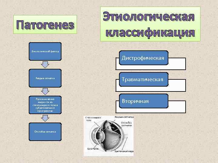 Патогенез Этиологическая классификация Этиологический фактор Дистрофическая Разрыв сетчатки Проникновение жидкости из стекловидного тела в