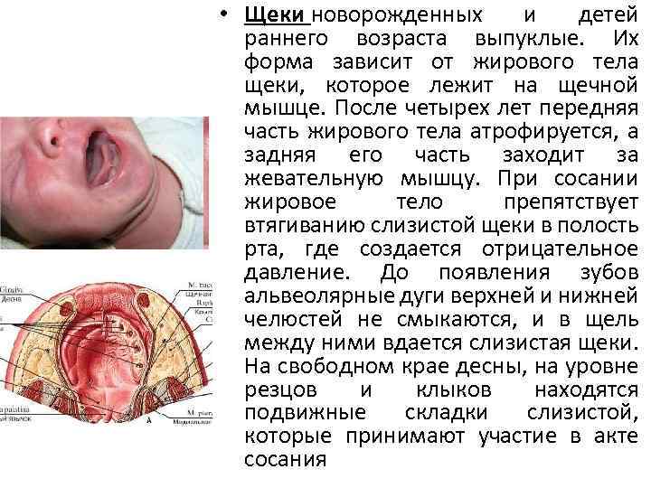  • Щеки новорожденных и детей раннего возраста выпуклые. Их форма зависит от жирового