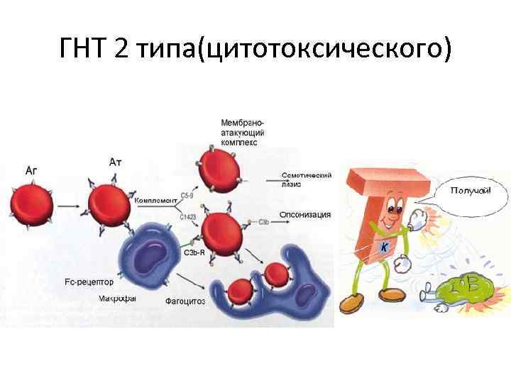 ГНТ 2 типа(цитотоксического) 