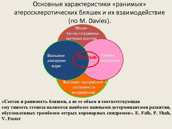 Основные характеристики «ранимых» атеросклеротических бляшек и их взаимодействие (по M. Davies). Малое число гладкомышечных