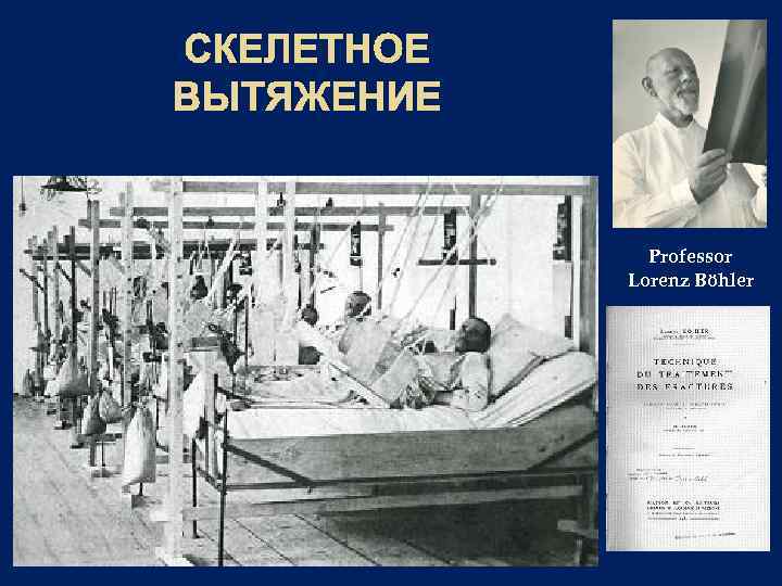 СКЕЛЕТНОЕ ВЫТЯЖЕНИЕ Professor Lorenz Böhler 