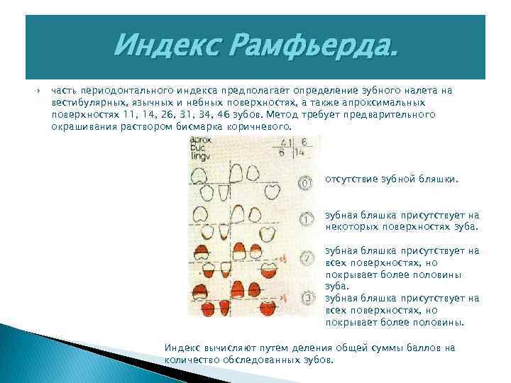 Индекс Рамфьерда. часть периодонтального индекса предполагает определение зубного налета на вестибулярных, язычных и небных