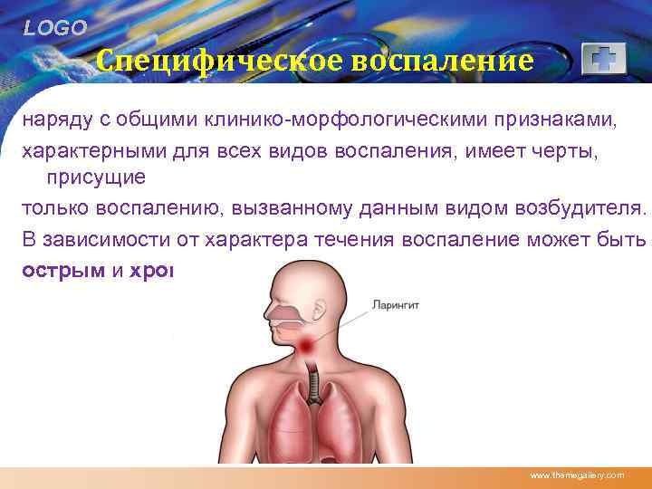 LOGO Специфическое воспаление наряду с общими клинико-морфологическими признаками, характерными для всех видов воспаления, имеет