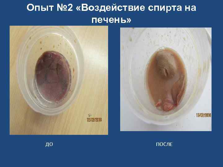 Опыт № 2 «Воздействие спирта на печень» ДО ПОСЛЕ 