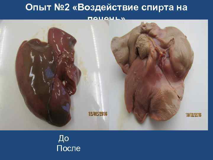 Опыт № 2 «Воздействие спирта на печень» До После 