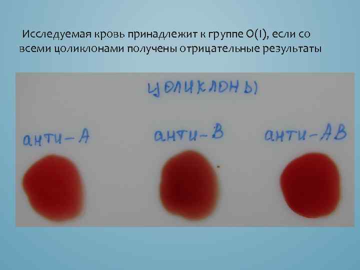  Исследуемая кровь принадлежит к группе О(I), если со всеми цоликлонами получены отрицательные результаты