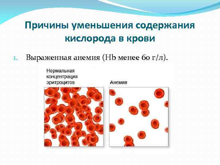 Понизить кислород