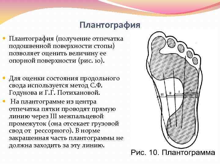 Поверхности стопы