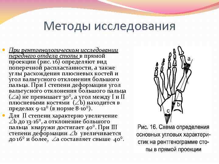 Методы исследования При рентгенологическом исследовании переднего отдела стопы в прямой проекции (рис. 16) определяют