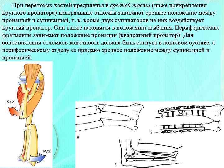 Перелом нижней трети предплечья карта вызова