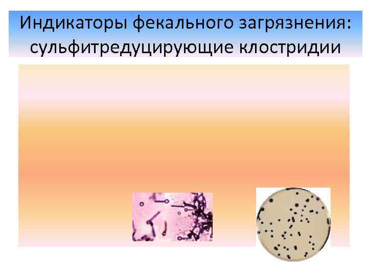 Индикаторы фекального загрязнения: сульфитредуцирующие клостридии 