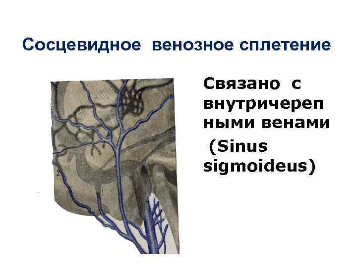 Сосцевидное венозное сплетение Связано с внутричереп ными венами (Sinus sigmoideus) 