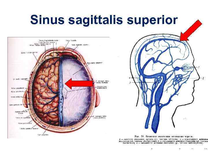Sinus sagittalis superior 