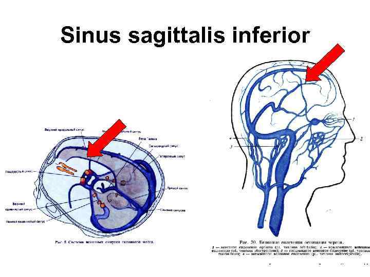 Sinus sagittalis inferior 