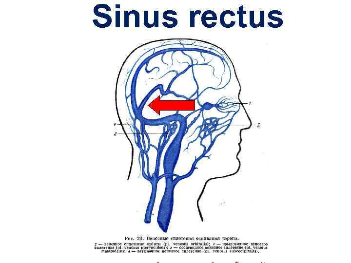Sinus rectus 