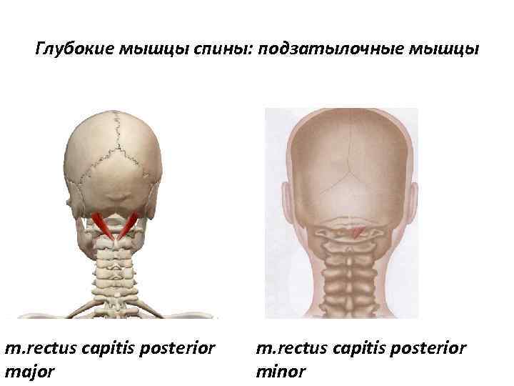 Глубокие мышцы спины: подзатылочные мышцы m. rectus capitis posterior major m. rectus capitis posterior