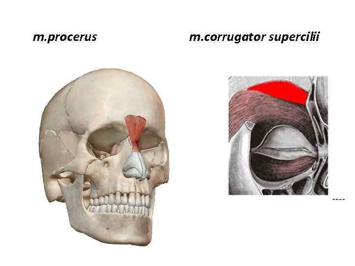 m. procerus m. corrugator supercilii 