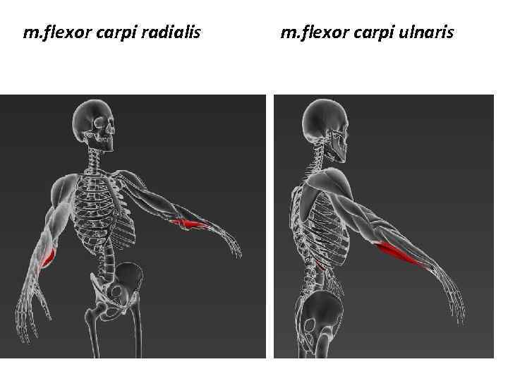 m. flexor carpi radialis m. flexor carpi ulnaris 