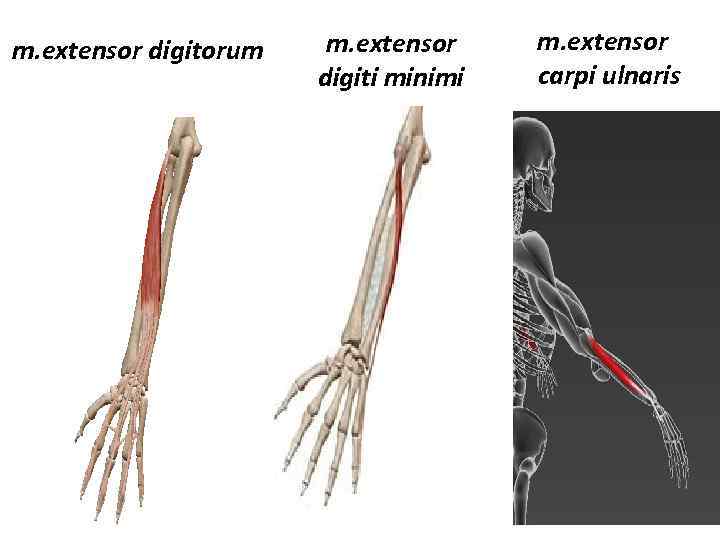 m. extensor digitorum m. extensor digiti minimi m. extensor carpi ulnaris 