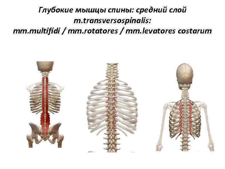 Глубокие мышцы спины: средний слой m. transversospinalis: mm. multifidi / mm. rotatores / mm.