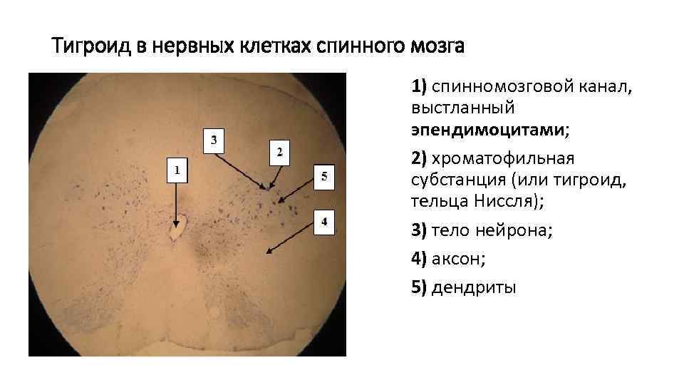 Тигроид в нервных клетках спинного мозга 1) спинномозговой канал, выстланный эпендимоцитами; 2) хроматофильная субстанция