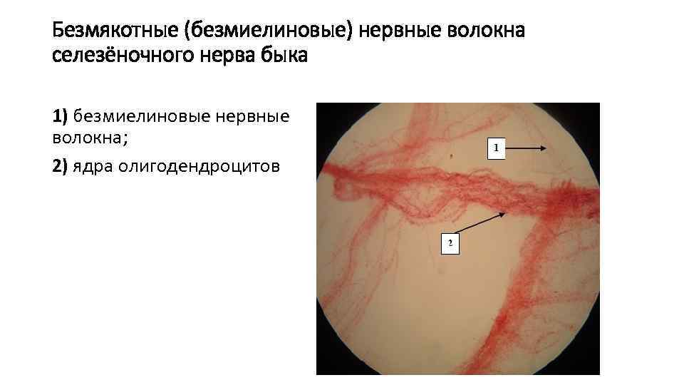 Безмякотные (безмиелиновые) нервные волокна селезёночного нерва быка 1) безмиелиновые нервные волокна; 2) ядра олигодендроцитов