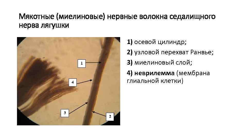 Мякотные (миелиновые) нервные волокна седалищного нерва лягушки 1) осевой цилиндр; 2) узловой перехват Ранвье;