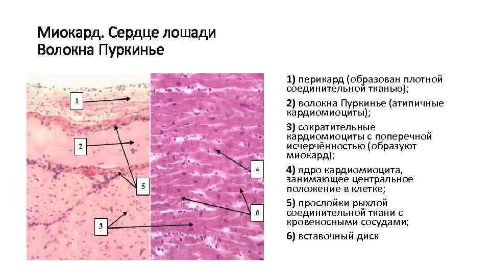 Миокард. Сердце лошади Волокна Пуркинье 1) перикард (образован плотной соединительной тканью); 2) волокна Пуркинье