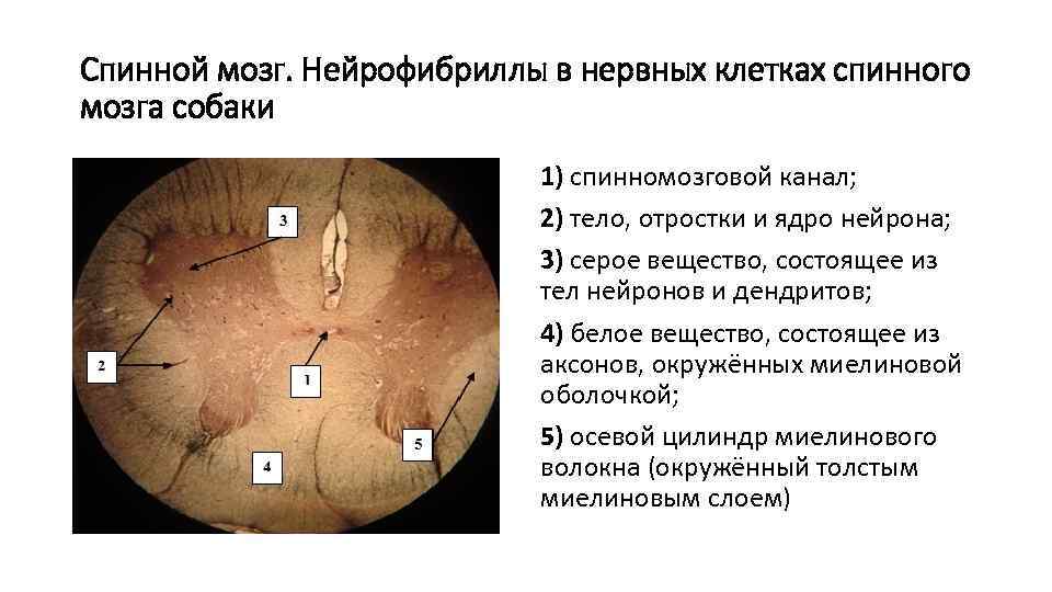 Спинной мозг. Нейрофибриллы в нервных клетках спинного мозга собаки 1) спинномозговой канал; 2) тело,