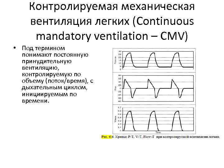 Контролируемая механическая вентиляция легких (Continuous mandatory ventilation – CMV) • Под термином понимают постоянную