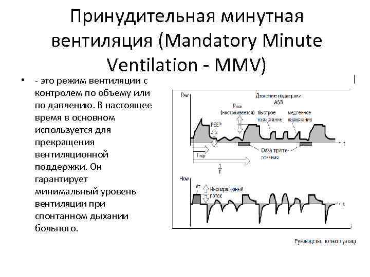 Принудительная минутная вентиляция (Mandatory Minute Ventilation - MMV) • - это режим вентиляции с